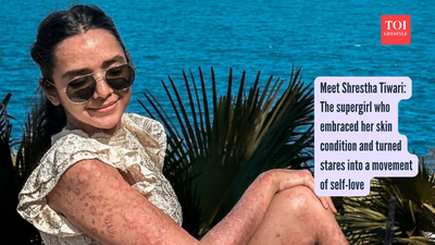 Meet Shrestha Tiwari: The supergirl who embraced her skin condition and turned stares into a movement of self-love