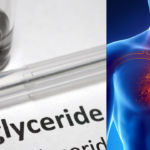 10 fruits that help bring triglycerides naturally and the 3 heart-healthy recipes