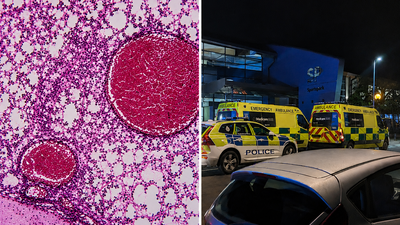 Meningitis outbreak sparks alarm after student dies and 2 others fall ill in Reading Area