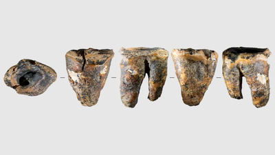 Neanderthals were performing dental surgery nearly 60,000 years ago and it surprisingly worked