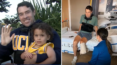This father lost a leg saving his 2-year-old daughter; says it’s a “trade I’d make any day” |