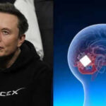 China beats Elon Musk's 'Jesus-level technology' to launch world's first commercial brain chip