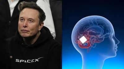 China beats Elon Musk's 'Jesus-level technology' to launch world's first commercial brain chip