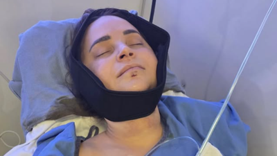YouTuber Rosanna Pansino undergoes surgery after breaking jaw in boat accident