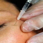 Zombie filler: Dead people's fat is the latest beauty trend