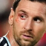 No easy wins in FIFA World Cup: Lionel Scaloni says 'suffering part of our DNA' as Argentina survive Switzerland scare | Football News