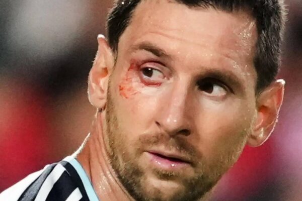 No easy wins in FIFA World Cup: Lionel Scaloni says 'suffering part of our DNA' as Argentina survive Switzerland scare | Football News