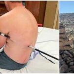 A man impales himself on trekking pole while climbing Montana's highest peak, hikes 10 miles to safety instead of calling a helicopter