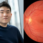 Award-winning innovation: 17-year-old New Jersey student built an AI that detects autism and ADHD with a retinal scan