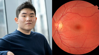 Award-winning innovation: 17-year-old New Jersey student built an AI that detects autism and ADHD with a retinal scan