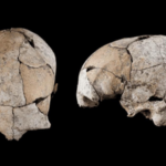 Buried for 5,300 years beneath a Stone Age tomb, a skull discovered in Spain has revealed the world's earliest known ear surgery