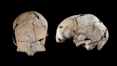 Buried for 5,300 years beneath a Stone Age tomb, a skull discovered in Spain has revealed the world's earliest known ear surgery