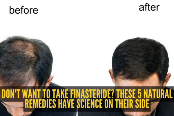 5 natural alternatives to Finasteride that could help with hair growth