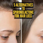5 alternatives to Spironolactone to reverse hair loss