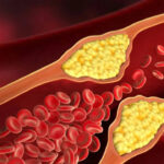 7 warning signs that could appear on your eyes, skin, and legs