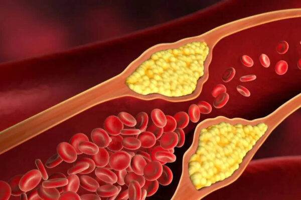 7 warning signs that could appear on your eyes, skin, and legs