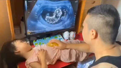 Parenting Tips For Healthy Eating: Father tricks daughter with fake ultrasound to stop her from eating junk food; why ultra-processed foods are hard to resist and how parents can promote healthy eating habits