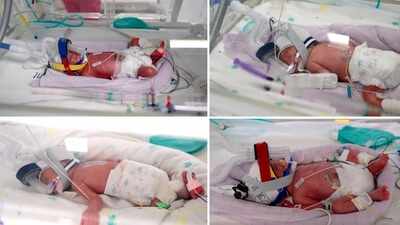 Australian woman gives birth to rare identical quadruplet girls after naturally conceived pregnancy |