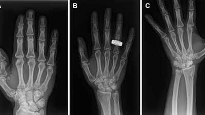 For the first time in history, astronauts use portable X-ray technology in space that could pave the way for future Moon and Mars missions