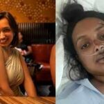 'I told him to drive slowly, but he kept...': A woman booked a bike ride to work and woke up with 9 broken ribs, no spleen, and a company that never called back