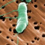 Florida's first flesh-eating bacteria death of 2026 raises concerns during beach season as warm waters fuel infections