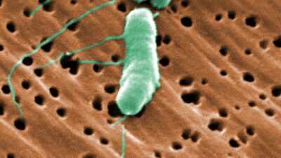 Florida's first flesh-eating bacteria death of 2026 raises concerns during beach season as warm waters fuel infections