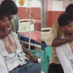 Snake bite horror in Hardoi: UP man bitten by venomous snake, brother slaps him 150 times to keep him alive