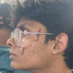 IP University PRO’s son allegedly attacked by neighbours in Dwarka, FIR not registered yet