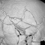 A skeleton found beneath Scotland's Stirling Castle had more than 160 fractures; researchers say it is the first confirmed death from a trebuchet