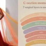 "Layers of Life", gown designed by Keesha Abdallah is inspired by 7 anatomical layers involved in a Caesarean section